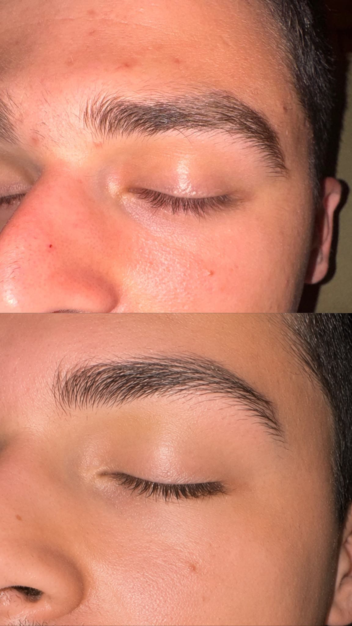 Antes e depois de sobrancelha