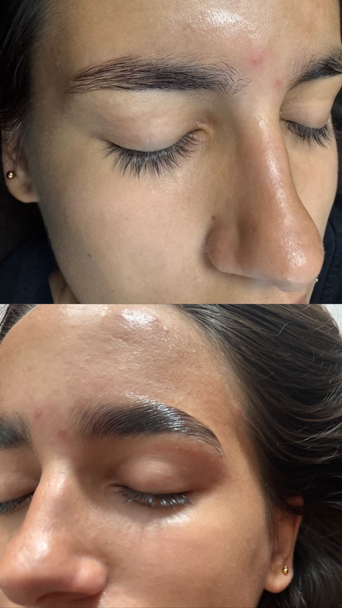 Antes e depois de sobrancelha